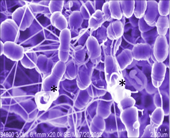 ucam-inicia-estudio-conjunto-sobre-los-caramelos-abedulce Streptococcus-mutans