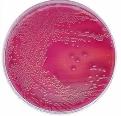 ucam-inicia-estudio-conjunto-sobre-los-caramelos-abedulce Streptococcus-mutans xilitol